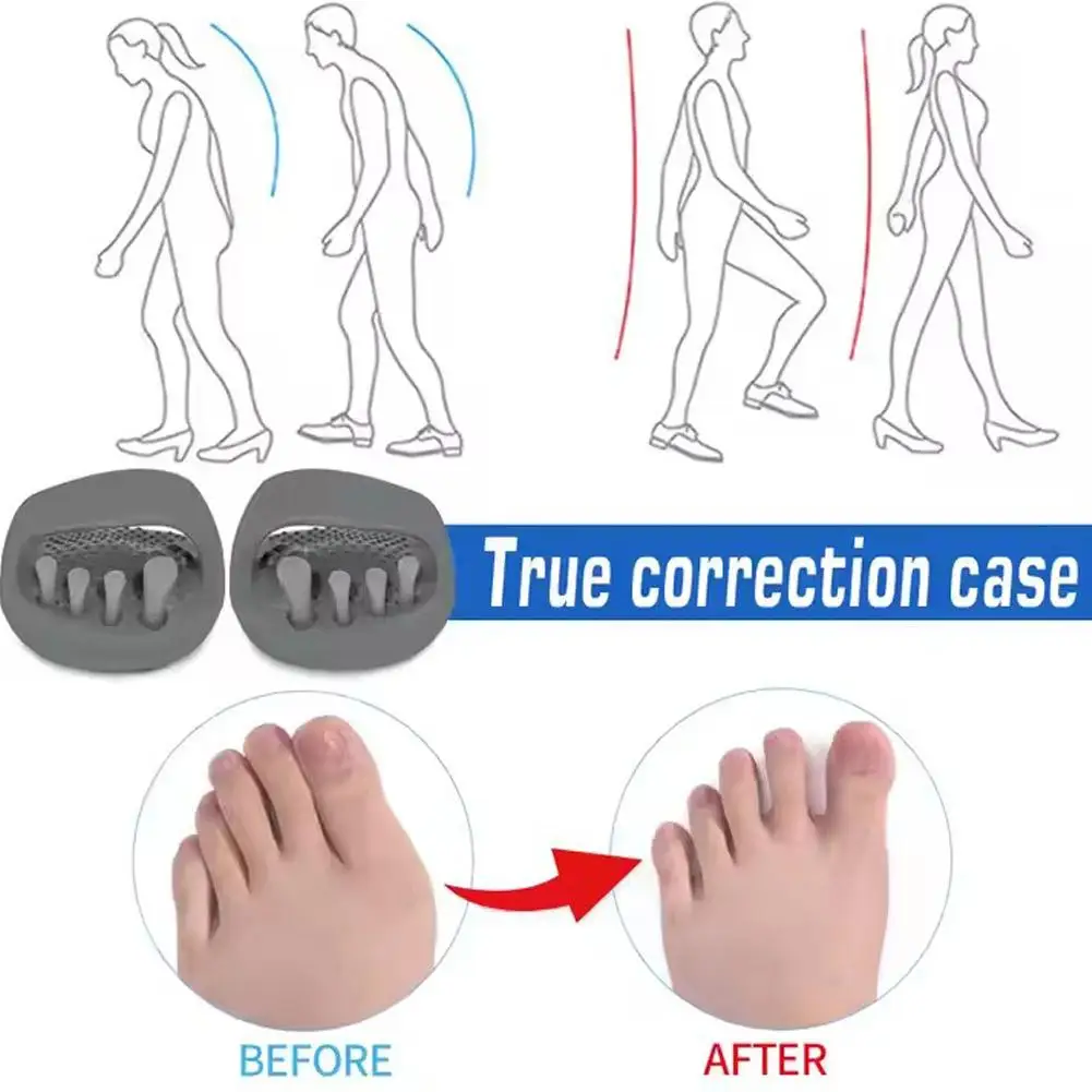 

Тапочки для коррекции осанки для взрослых, биомеханический дизайн для бантиков/колен, унисекс, стельки для выравнивания ног, немедические