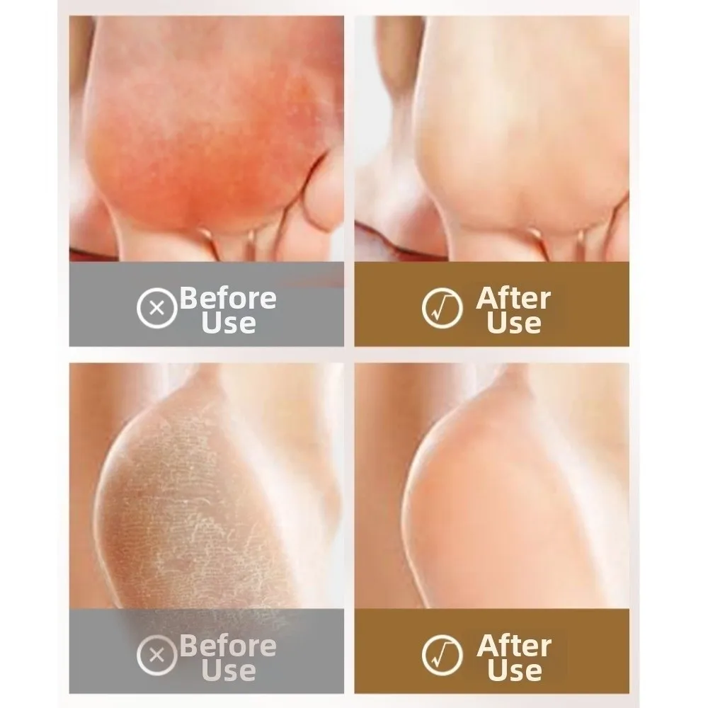 Invisible Ankle Protection Socks Compression Support High Elasticity Heel Protector Hosiery Prevent Cracked Moisturizing