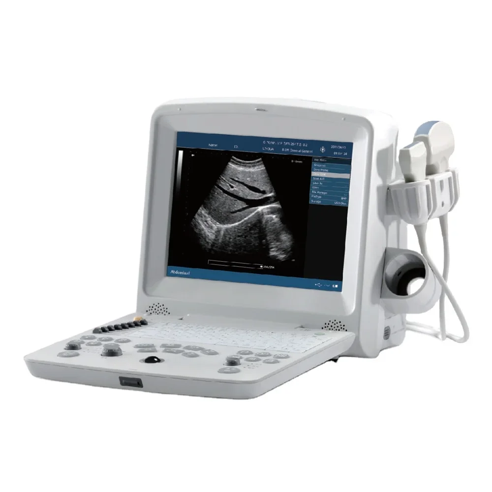 cheap Laptop portable mini human or animal ultrasound scanner machine