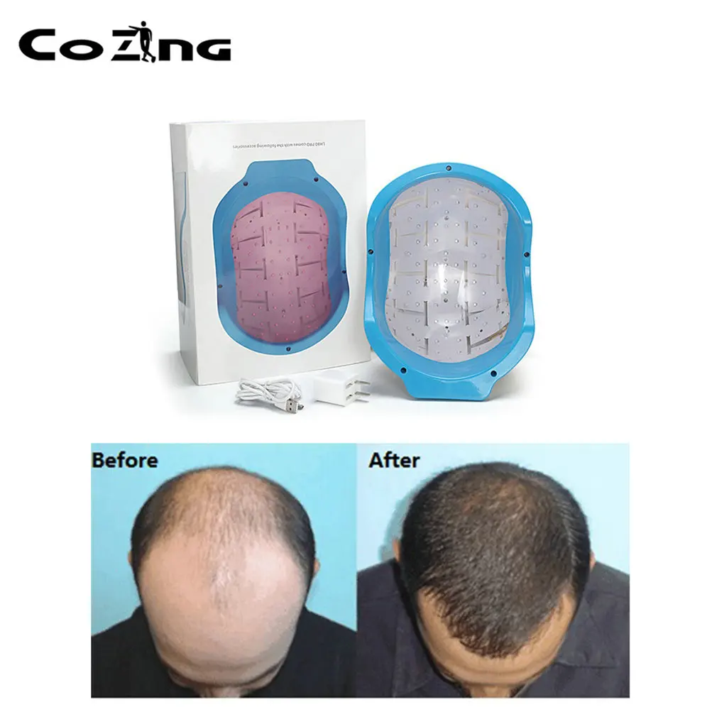 

Hair Growth 80 Laser Diodes Hair Loss Treatments for Men and Women Hair Regrowth Laser Cap for Thinning Hair