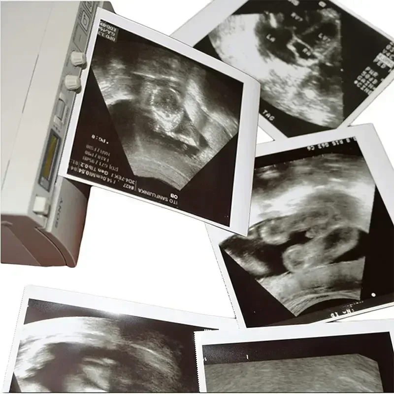 10 rollos de papel de impresión por ultrasonido Compatible con papel térmico altamente brillante UPP-110HG para Sony