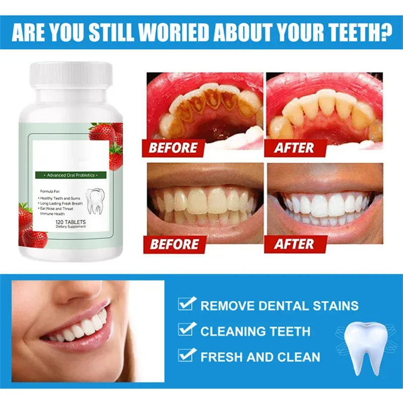 Teeth Brightening Whitening Dental Calculus Remover Removal Bad Breath Preventing Periodontitis Dental Repair Clean Care Tablets