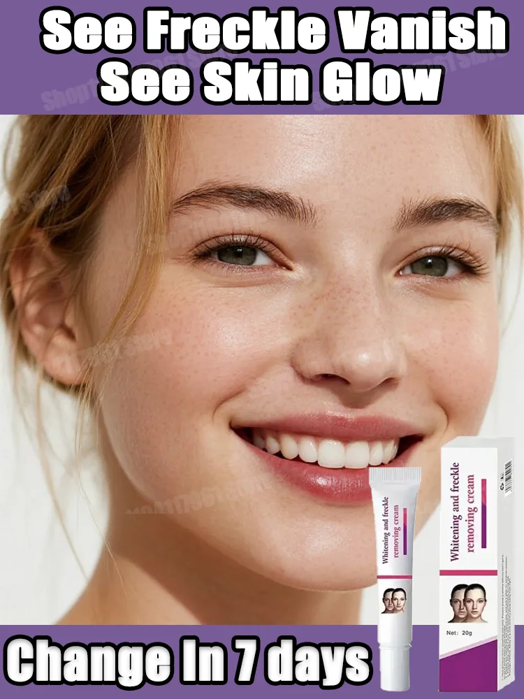 

Whitening Freckle Cream Remove Dark Spots Anti Freckle Face Creams Niacinamide Fade Pigmentation Melasma Brighten Skin Care