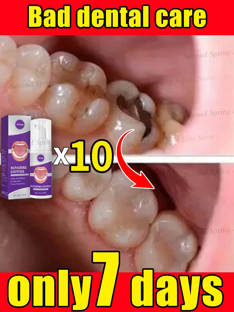 

Repair teeth, prevent tooth decay, and effectively remove dental plaque