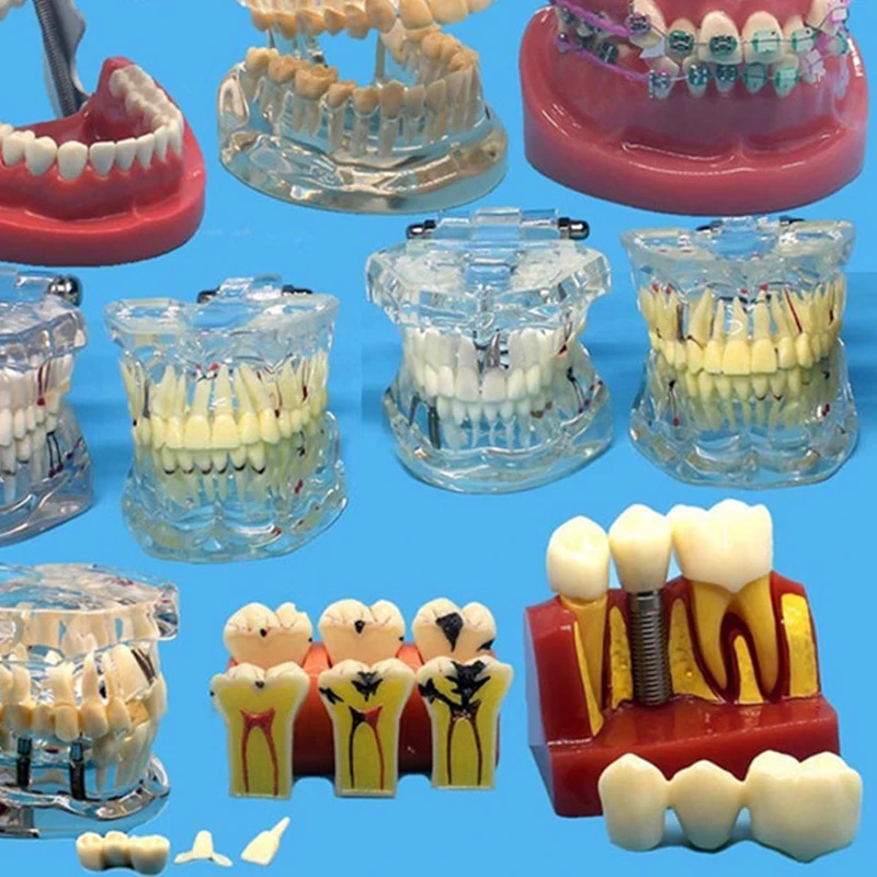 Various dental models for teaching and hospital dental materials