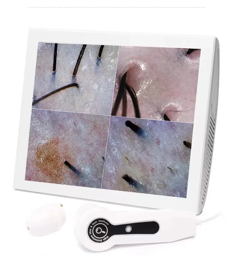 Portable high-definition dual-probe tester analyzes scalp follicles as well as skin