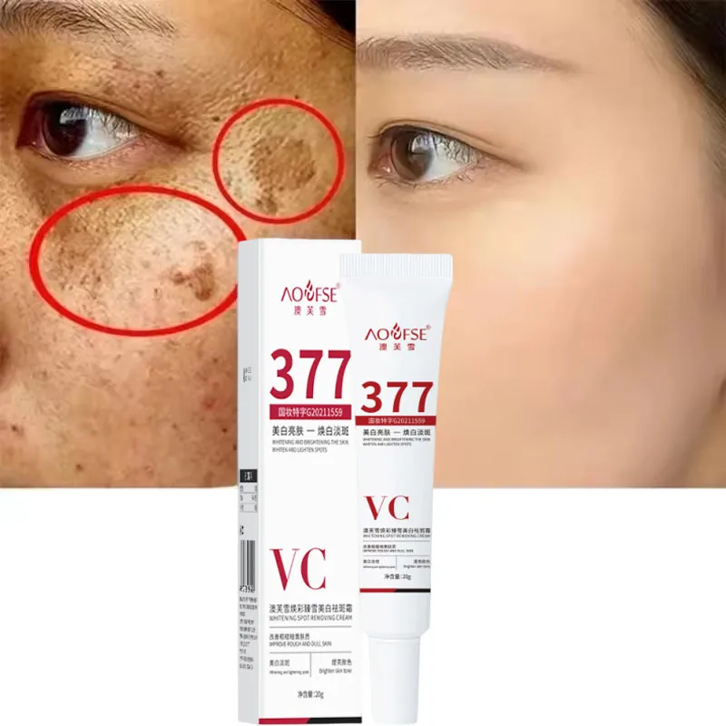 

Niacinamide Melasma Brightening Cream Reduce Melanin Brighten Cream Lighten Dark Skin Chloasma Repair Serum Face Care Products