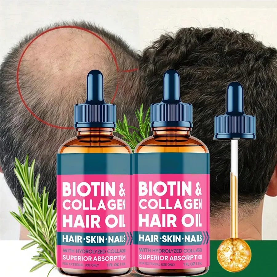 

2-е настроение Biotin, быстрорастущие эфирные масла для ухода за волосами, масло против выпадения волос, увлажняющее волосы, для мужчин и женщин