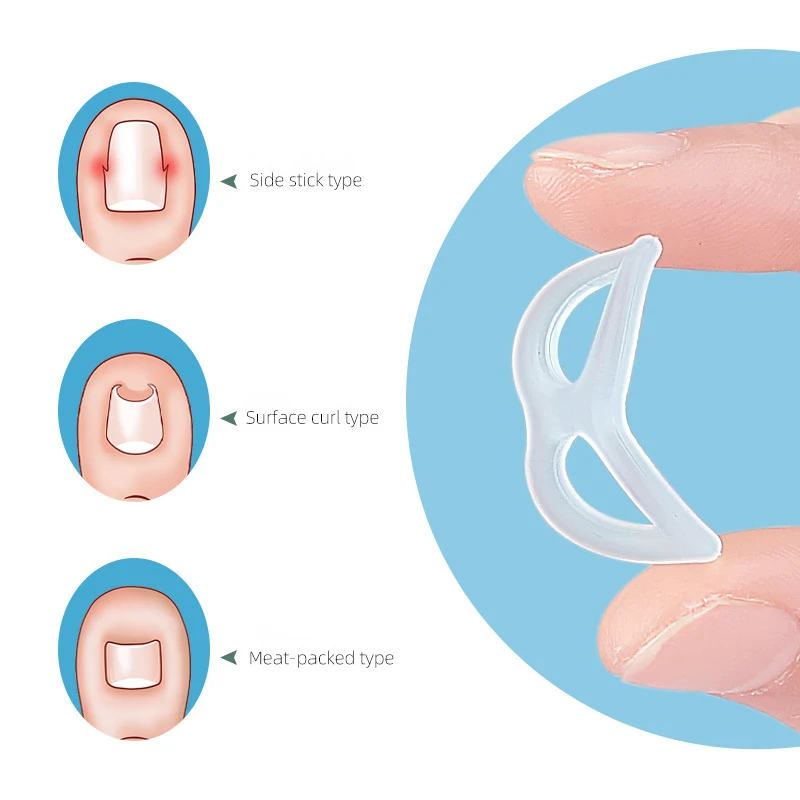 Strumento di correzione dell'unghia incarnita in Silicone strumento di protezione per il raddrizzamento dell'unghia incarnita invisibile Brace Pedicure strumenti per la cura dei piedi