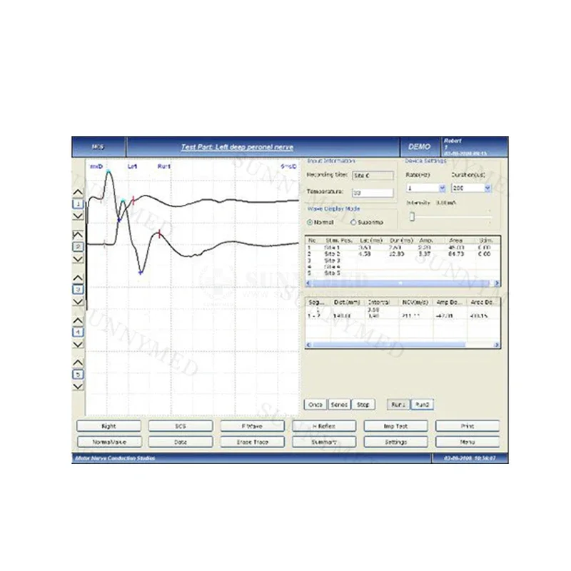 SY-H009 CE approved EMG equipment medical test system Low noise Electromyography device