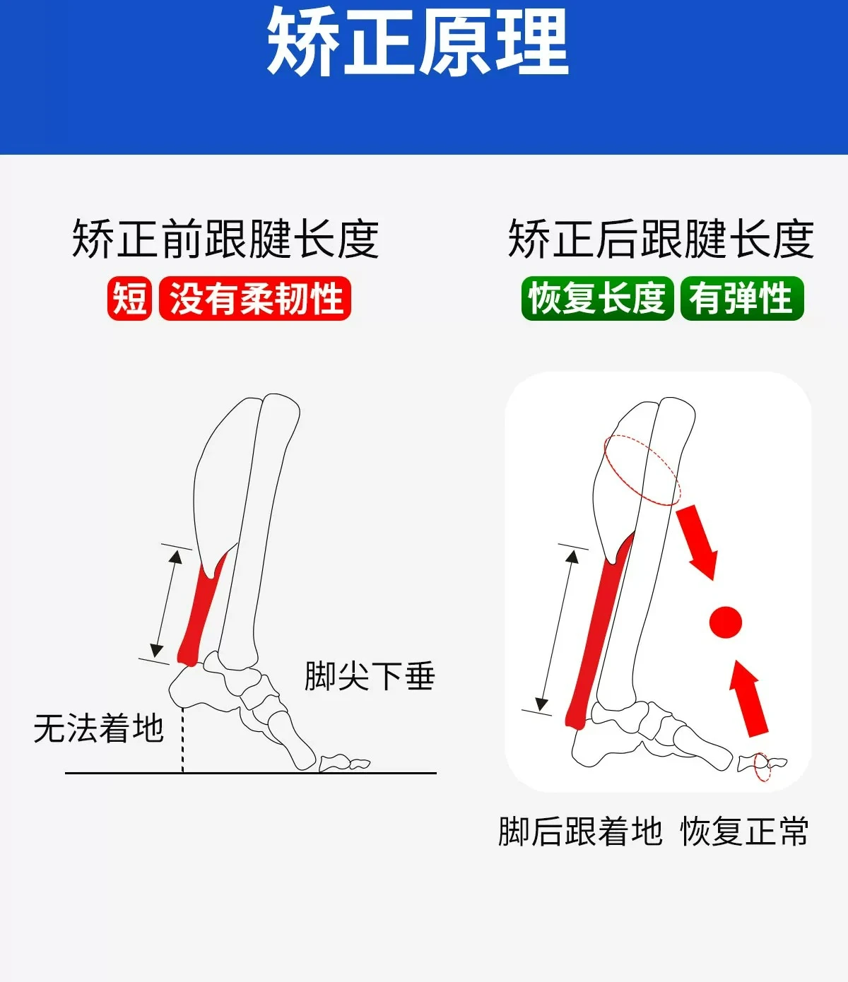 Picture 6: Customizable Children Adult Tiptoe Foot Sagging Orthotics Pull Achilles Tendon Rear Heel Lying Bed Hemiplegia Braces