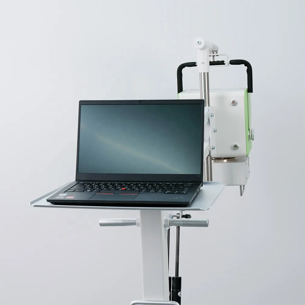 100mA Xray DR 5kW Unidade de raio X Equipamento de radiologia médica Máquina portátil de raio X digital móvel