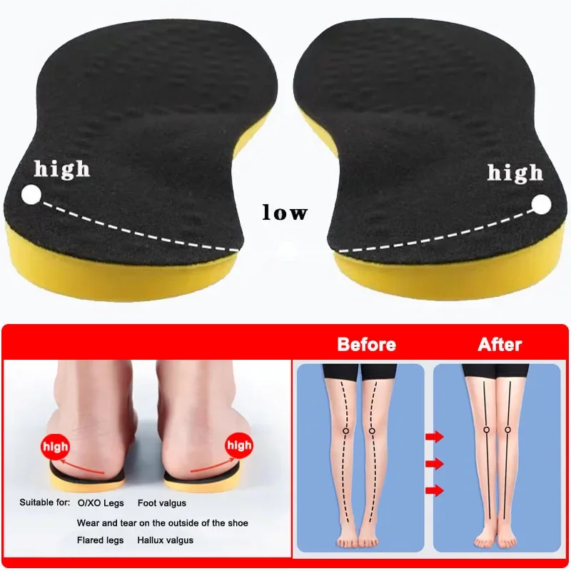 PU Orthotic Palmilha Para Pés Arch Foot Pad, Crianças X O Tipo Perna Correção, Flat Foot Arch Suporte, Calçados Esportivos Inserir