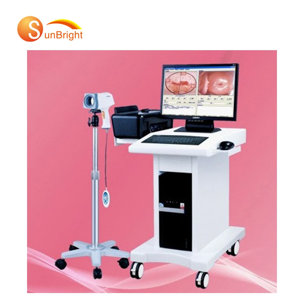 Digital Trolley colpo scope  High Resokution Electronic Colposcopy Best Price