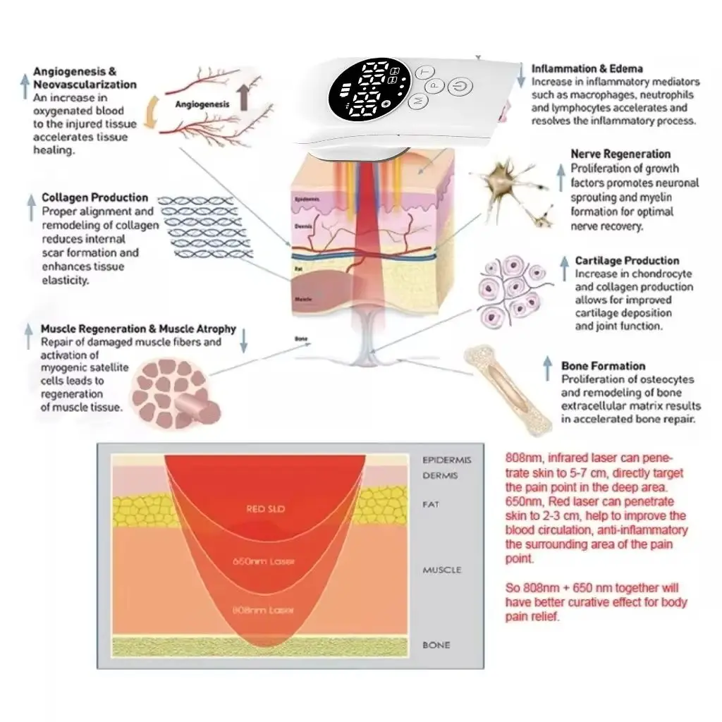 

650nm+808nm Low Level Soft Cold Laser Physiotherapy Device for Joint Muscle Pain Relief 520mW