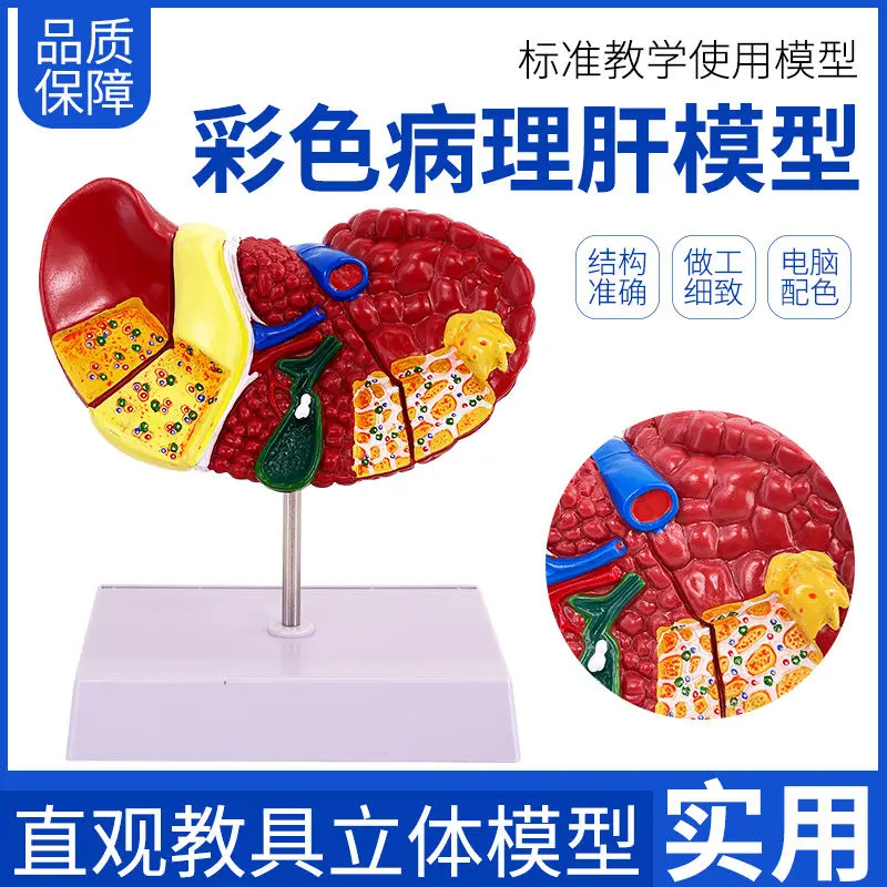 

Модель человеческой печени, анатомическая модель печени, гепатобилиарный панкреатив, селезенка, двосторонние уравнения, гепатобилиарный блинов, желчный пузырь, голубь