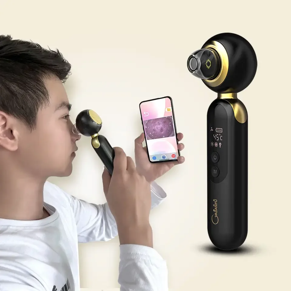 Hot & Cold Electric Vacuum Blackhead Remover Dark Spot Removal Device Beauty Products for Women