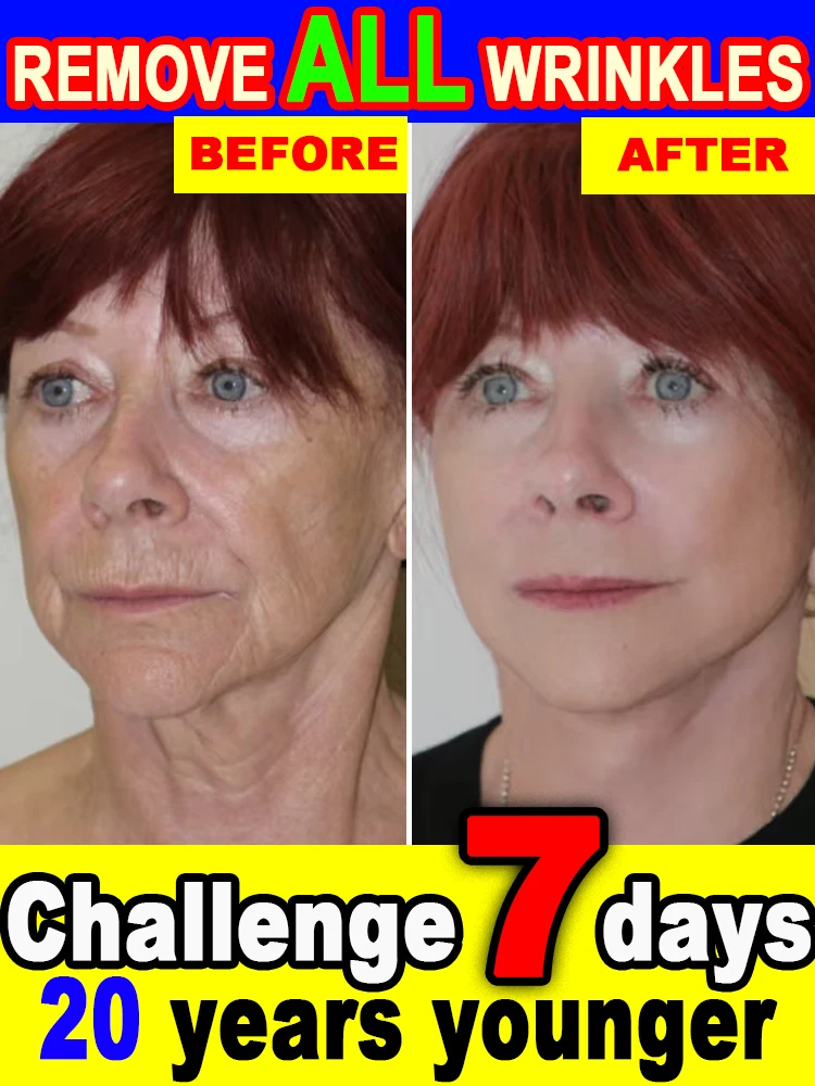 

20-летний ВАУЛЬСЬКИЙ, БЕЗ ТОНКИХ ЛИНЕЙ