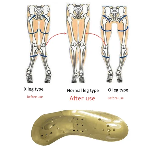 שרוול ברכיים ורגליים חמים