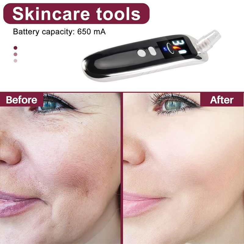 เครื่องดูดสิวเสี้ยนไฟฟ้า B47B-Face Nose Acne Black Dot Pimple Blackhead Remover กำจัดสิวหัวดำ ดูแลรูขุมขน พร้อมหัว 6 แบบ