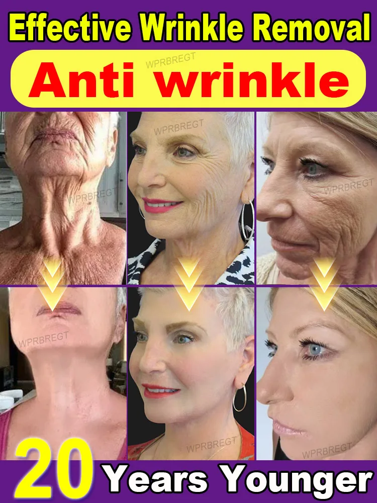 ไม่มีริ้วรอย อายุน้อยกว่า 20 ปี หน้าเต็มตัว