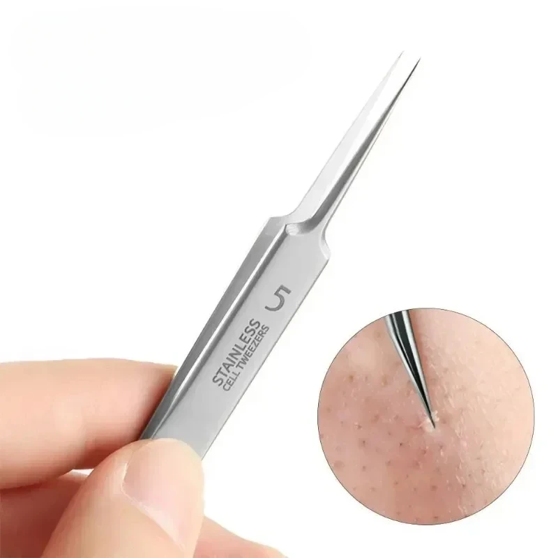 Blackhead Tweezers - Precision acne removal tool for facial whiteheads, acne, pimples - Stainless steel professional makeup tool