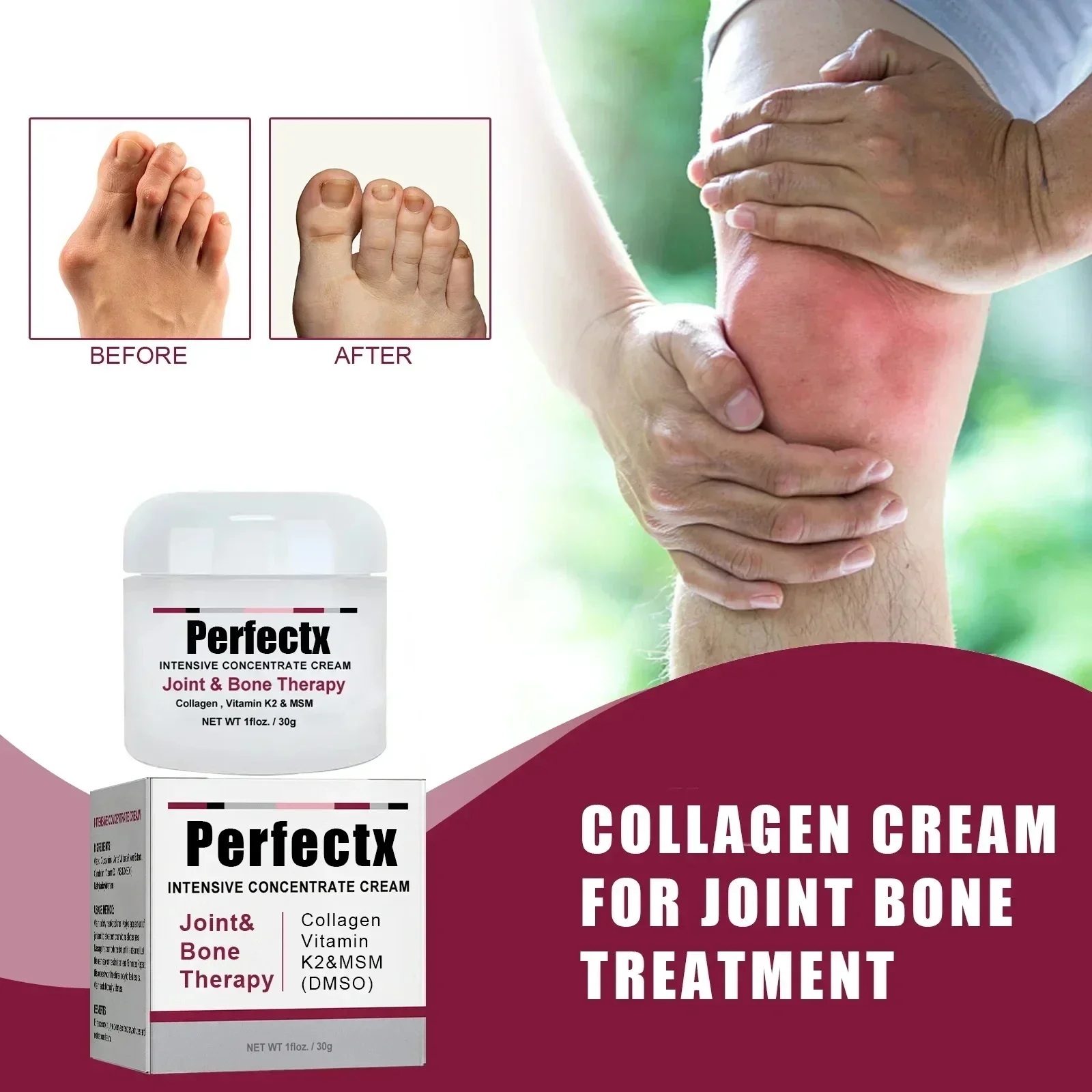 

Perfectx Collagen Tenosynovitis Treatment Ointment No Box Treatment Of Back Muscle Pain Joint Strain Neck Plaster Relief Cream