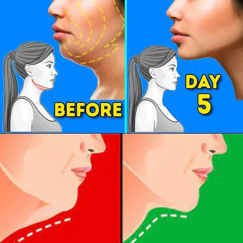 

Double Chin Removal Effective Products For woman