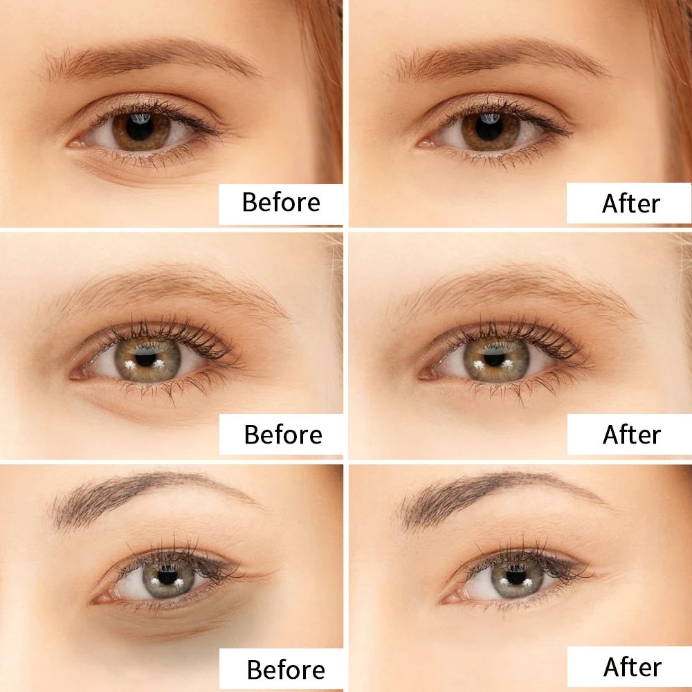 Masker mata kolagen kristal, 10 buah masker mata emas mengurangi lingkaran hitam garis halus Anti Penuaan, mengangkat mengencangkan Perawatan Kulit, tambalan kecantikan