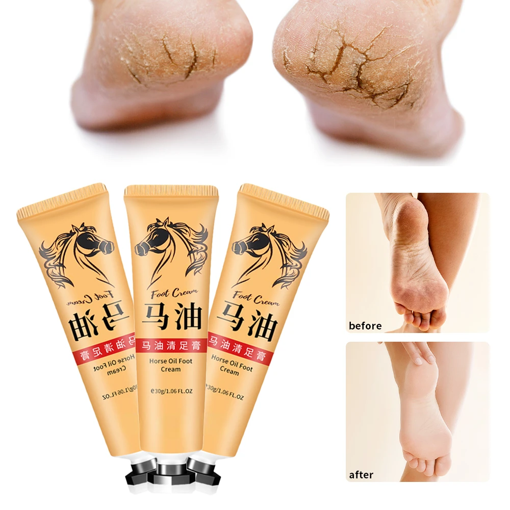 Crema antigrietas para pies, crema de aceite de caballo para reparación de talón agrietado, eliminación suave de callos de piel muerta, cuidado de la piel de los pies de manos antisecado, 30g