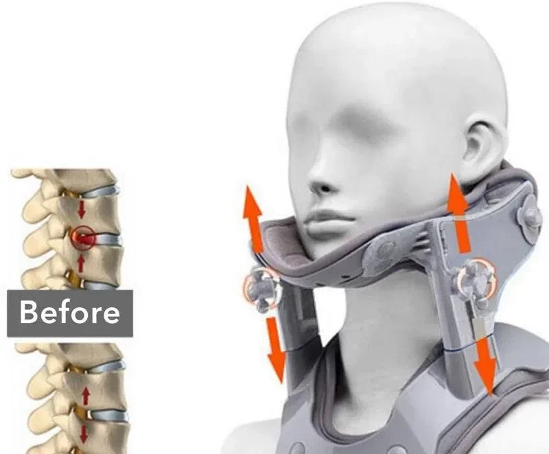 For Electric Heating Cervical Traction Device Adjustable Neck Support Brace Hot Compress Physiotherapy Spine Correction