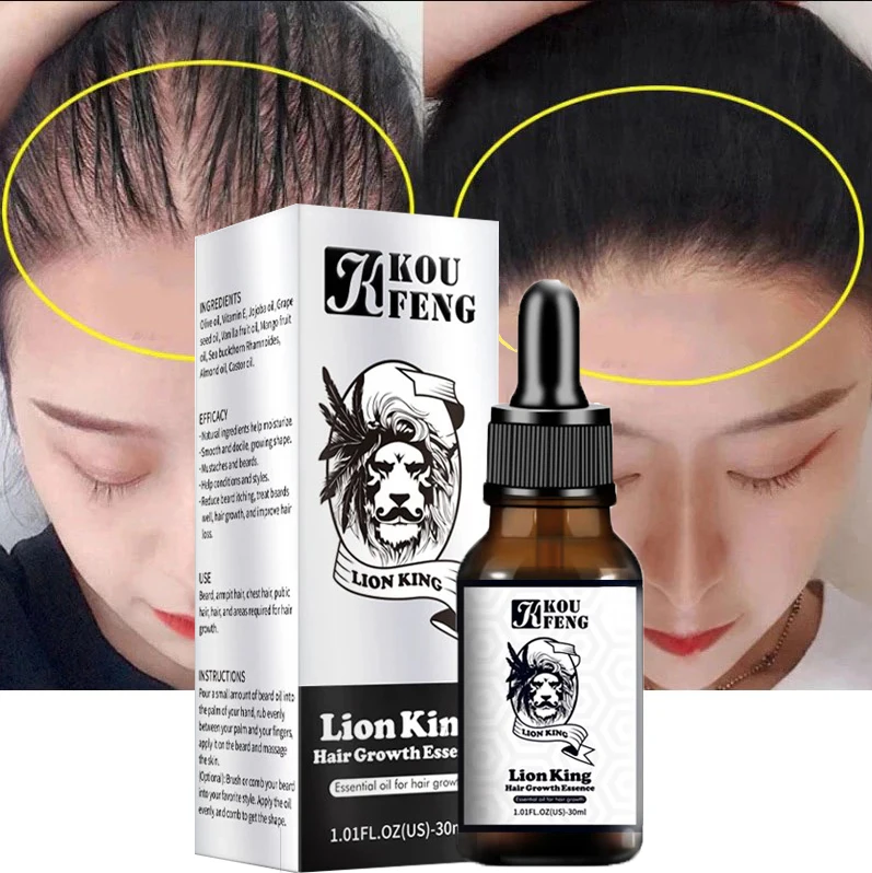 

Fast Hair Growth Oil Hair Growth Serum Hair Loss Follicle Treatment Thick Hair Growth Oil for Men and Women Hair Regrowth