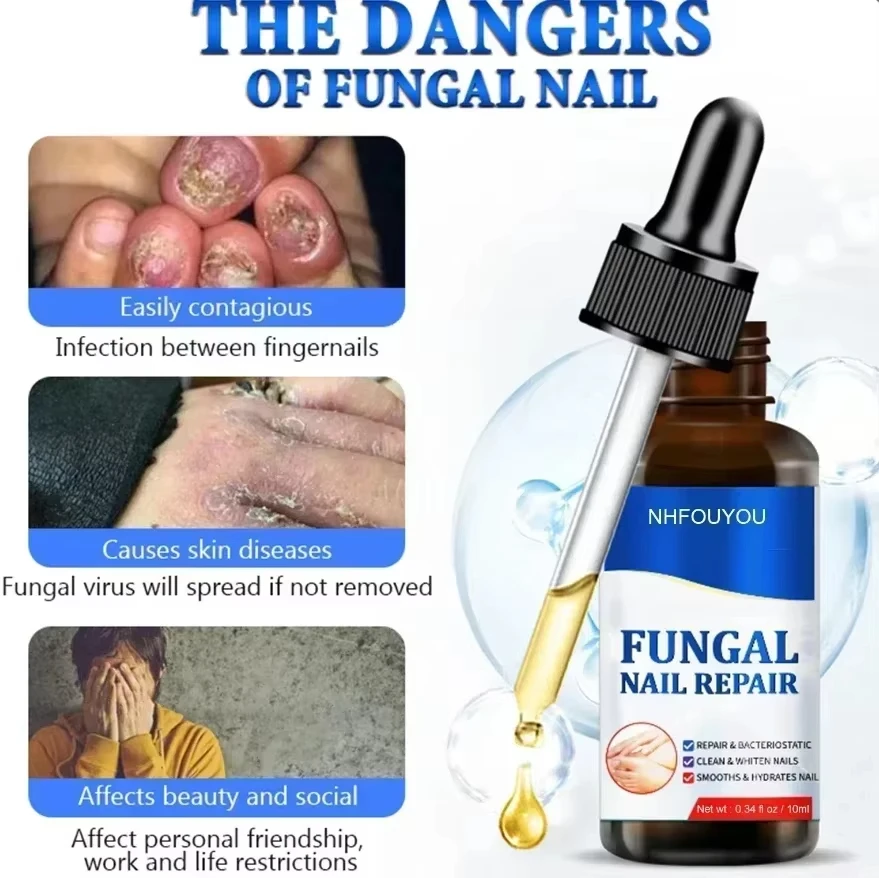 爪の真菌治療装置,爪囲炎,爪真菌症,足のケア