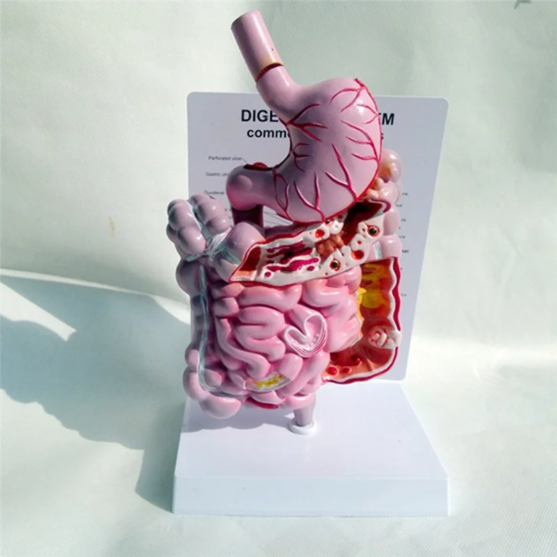 نموذج تشريح الأعضاء الداخلية البشرية الجهاز الهضمي المعدة الأمعاء Cecum Rectum نموذج هيكل الثنائي