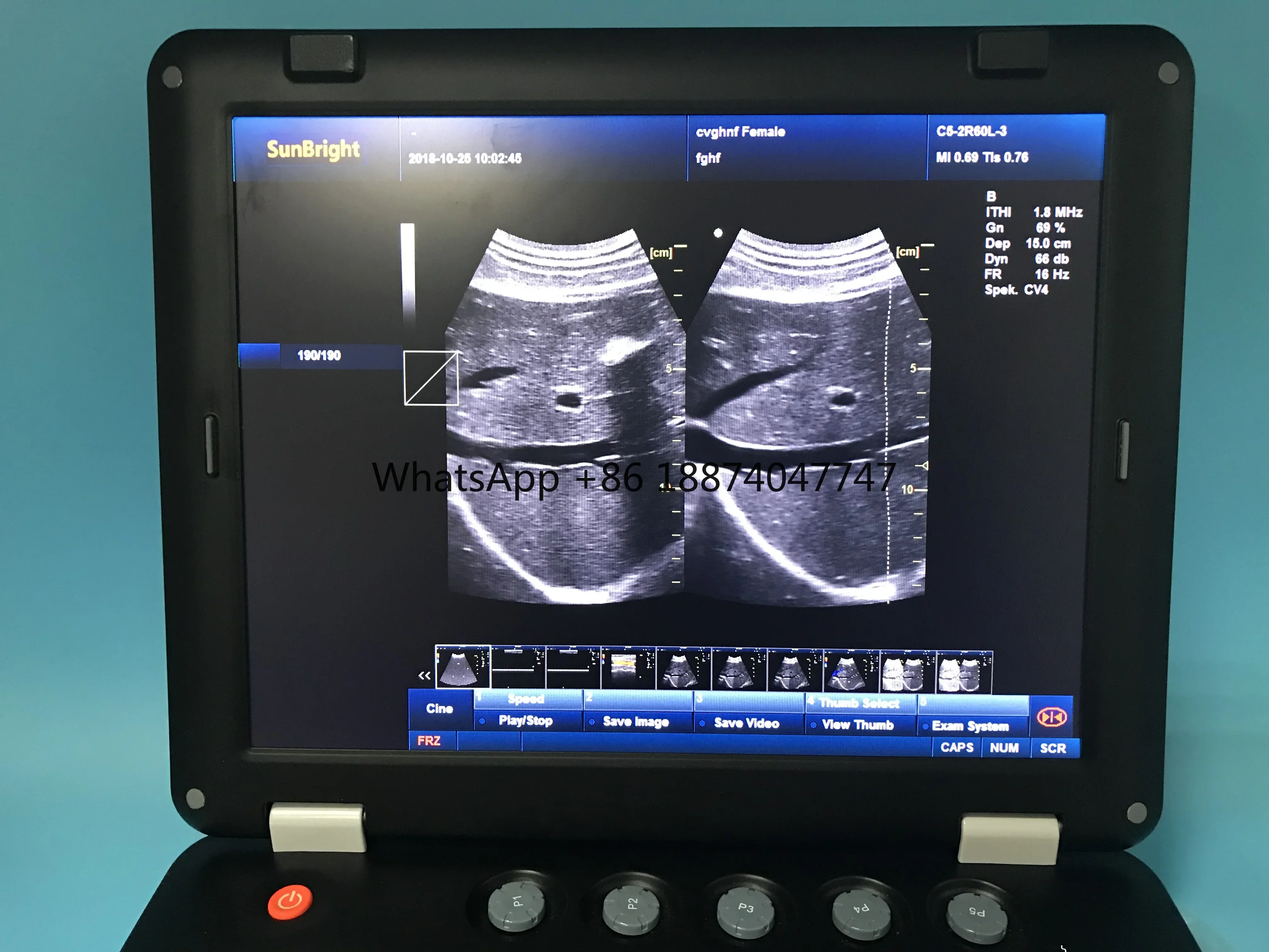 Portable 15 inch 2d 3d 4d B/W and Color Doppler Ultrasound Scanning Machine medical ultrasound instruments for