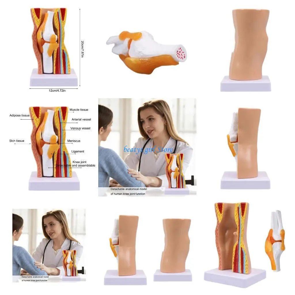 

C7AB Модель коленного сустава человека Анатомическая модель мышц коленного сустава человека