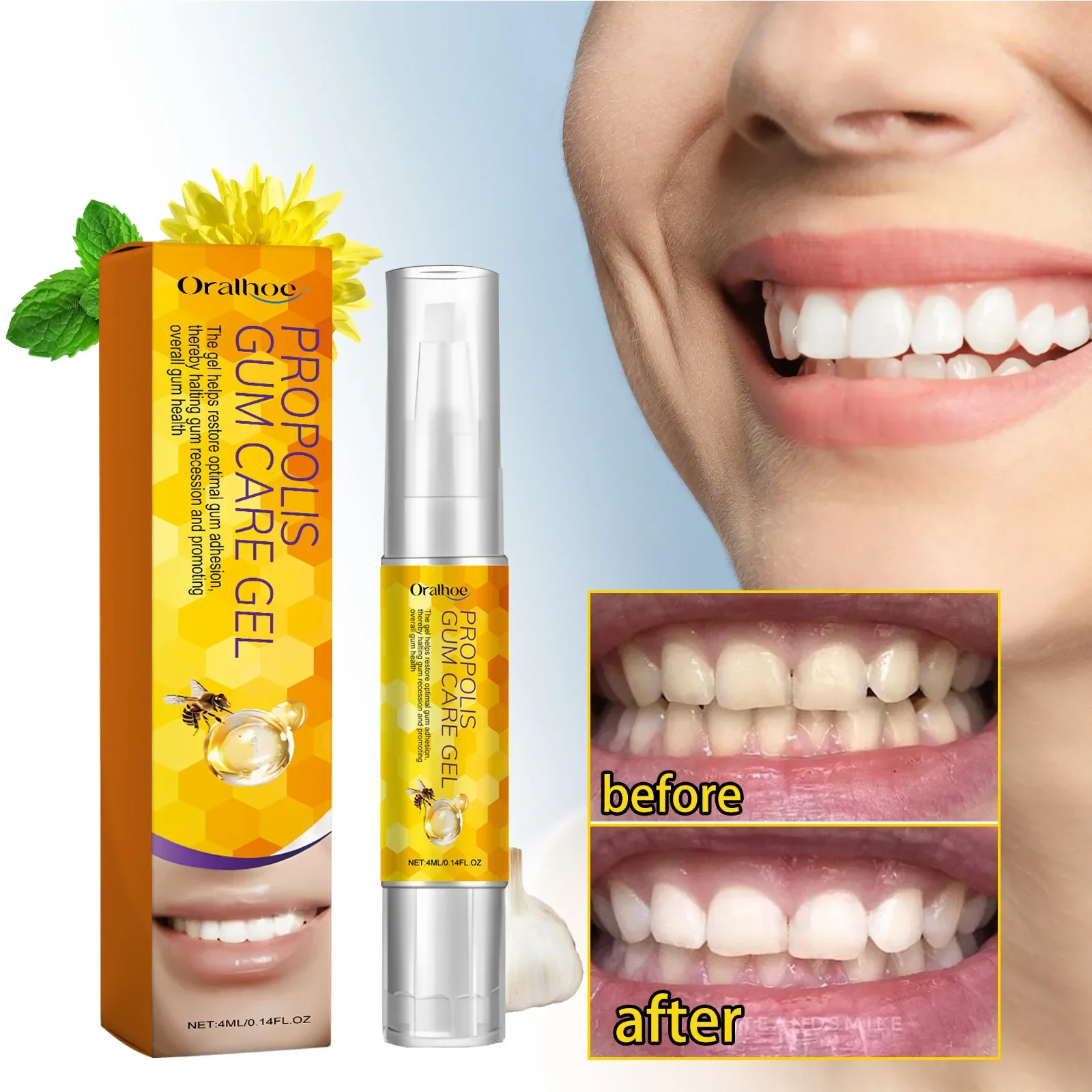 Propolis Gum Care Gel Promoting Overal Gum Health Clean and Repair Teeth Yellow Stains Whitening Teeth Tooth whitening 4ml