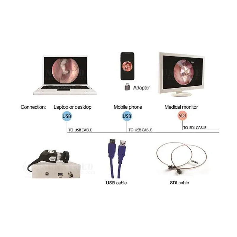 

SY-P031HD2 Medical 10 Watt portable video endoscopy camera with light source for all surgery