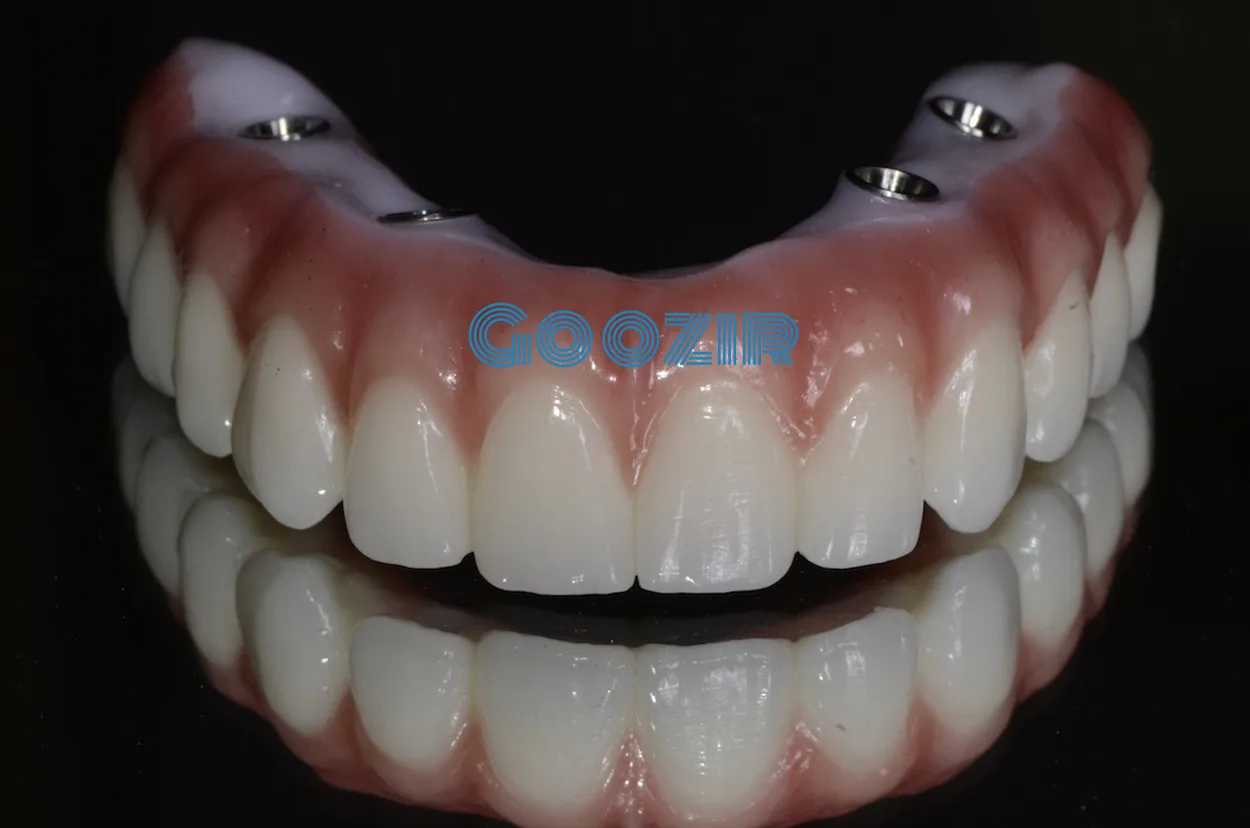 Venta al por mayor de alta calidad goozir 98mm a4 3d multi capa sompe redo zahn zirkonia suminis tros de laboratorio dental