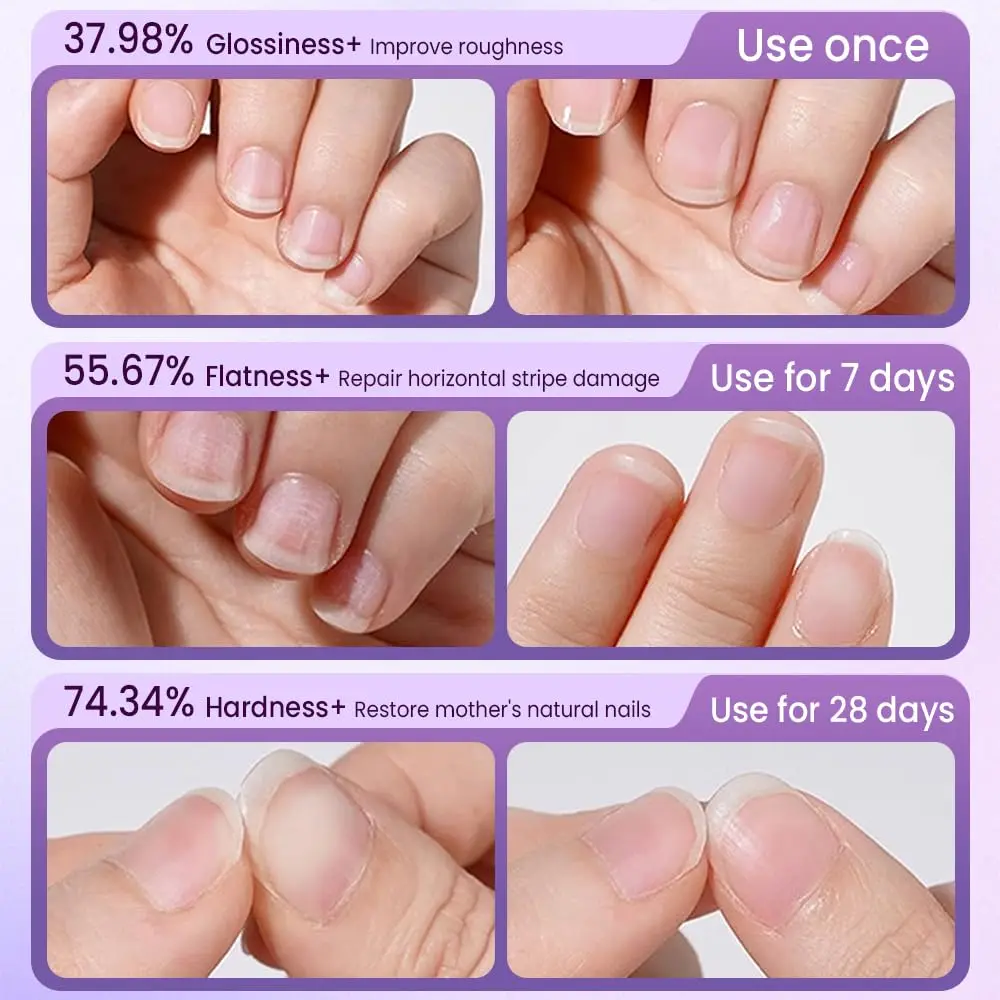 Neuer 3-in-1-Essenz-Nagelhautölstift, spendet Feuchtigkeit, Hangnails, trockene Schäden, Nägel, Nagelhautentferner, Stift, Nagelpflege, Maniküre-Werkzeug