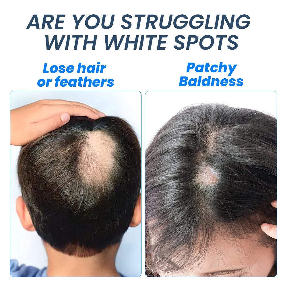 1/3/5/10Pcs Sumifun Hair Growing Spray Baldness Hair Root Regrowth Serum Liquid Black Hair Nourish Massage Care Health Plaster