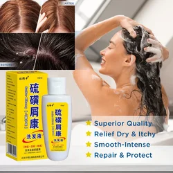 Sulfur Shampoo Anti-Dandruff for Scalp Itching