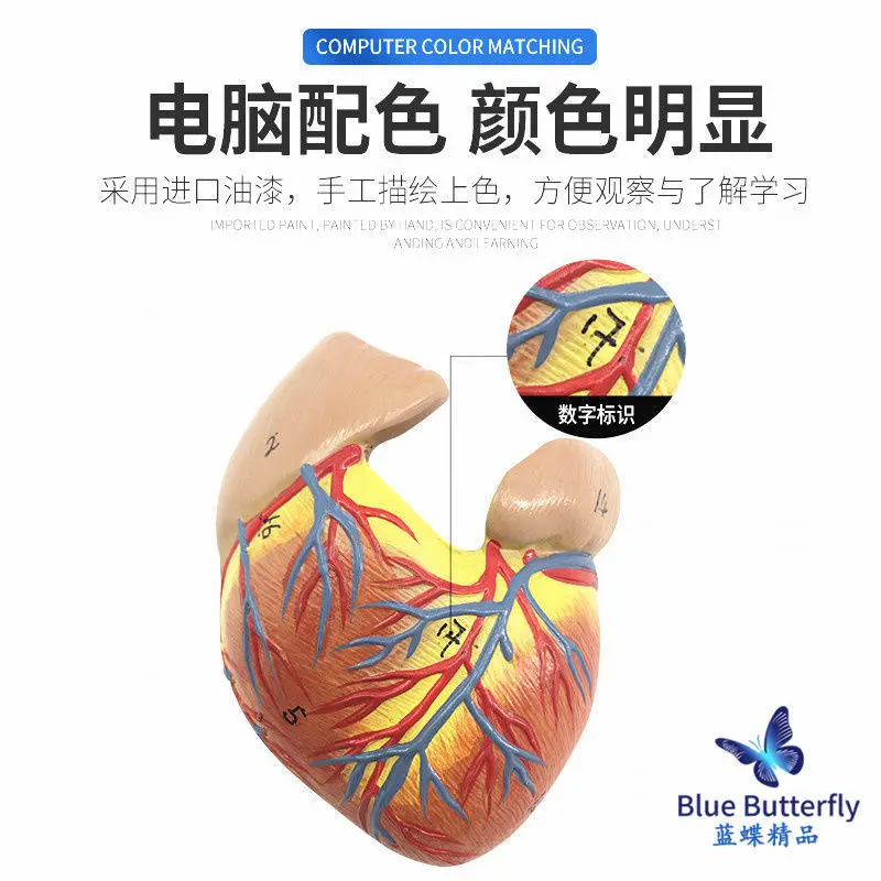 Anatomie modell des menschlichen Herzens/B-Ultraschall-Farbdoppler-Ultraschall-Herz modell/abnehmbares Herz medizinische Lehre