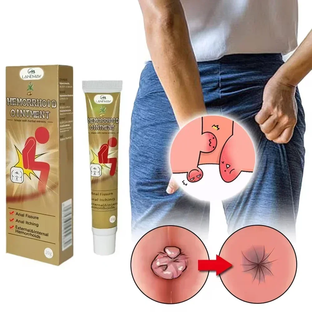 NewHemorrhoid Remover Cream Internal Piles Natural Herbal Extract Relieve Anal Anus Swelling Bleeding Gel Removal Hemorrhoids C