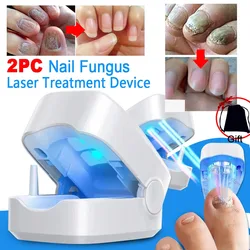 Nail Fungus Laser Treatment Device Repair Toenail Fingernail Fungus Treat Onychomycosis Therapy Cure Machine Effectively Remove