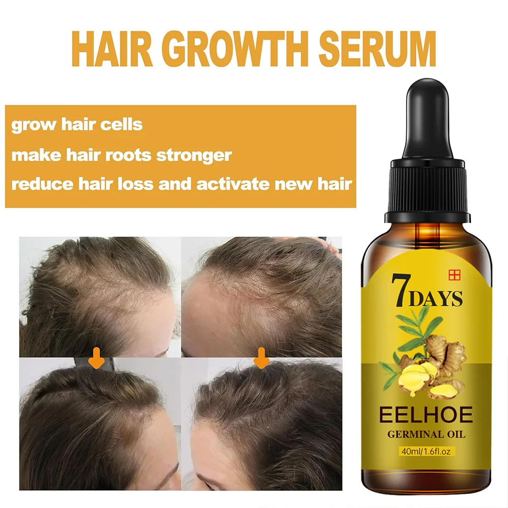 Hair Growth Serum Fast Growing Hair Essential Oil Beauty Hair Care 10/20/40ml Dense Regrowth Ginger Hair Promoting Regeneration