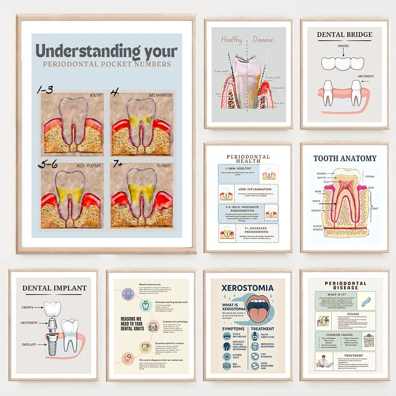 Modern Tooth Anatomy Poster Periodontal Disease Education Dental Hygiene Canvas Painting Wall Art Dental Office Room Decor Decor