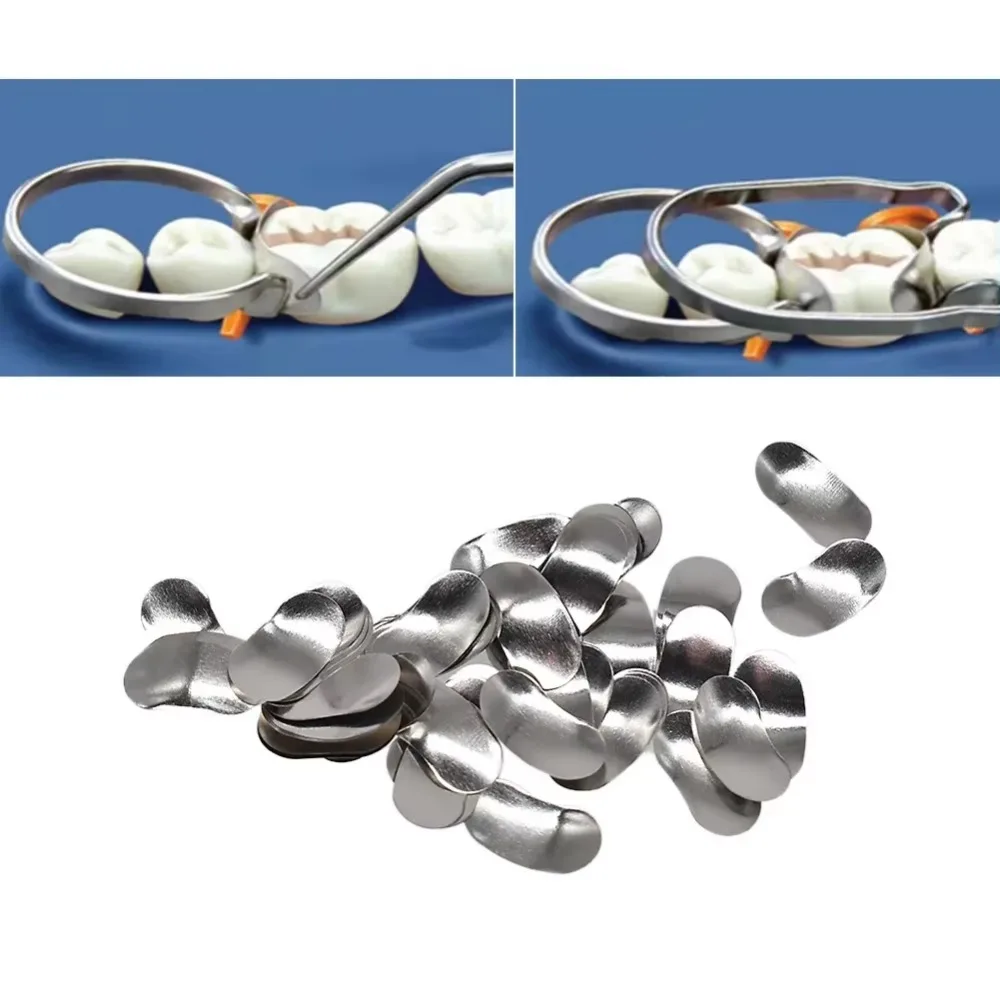 

AG 100 pcs Dental Sectional Matrix Contoured System Metal Dentistry Resin Clamping Seperating Ring Autoclavable dental