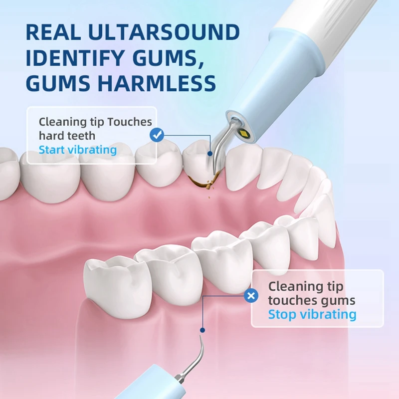 Portátil ultra-sônico LED Scaler, Oral tártaro removedor, Tooth Stain Cleaner, Clareamento dos dentes, Cálculo limpeza