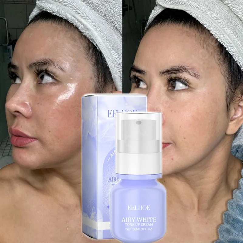 

Whitening Brightening Cream Remove Freckles Melasma Dark Spots Fade Pigmentation Acne Scars Moisturizing Beauty Facial Skin Care